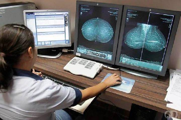Mais de 12 mil mulheres aguardam exames para investigação de câncer de mama em MT
