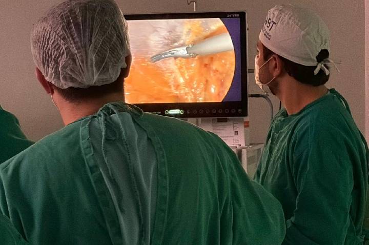 Começou: mutirão de cirurgias bariátricas atende pacientes que aguardavam na fila do SUS