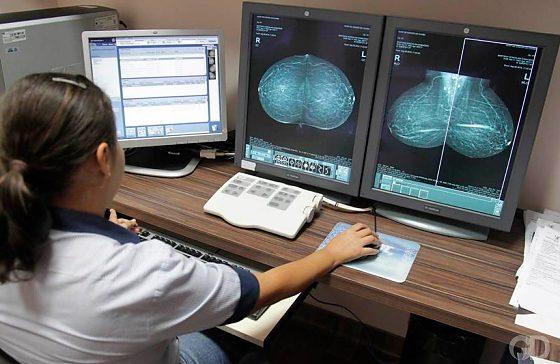 Mais de 12 mil mulheres aguardam exames para investigação de câncer de mama em MT